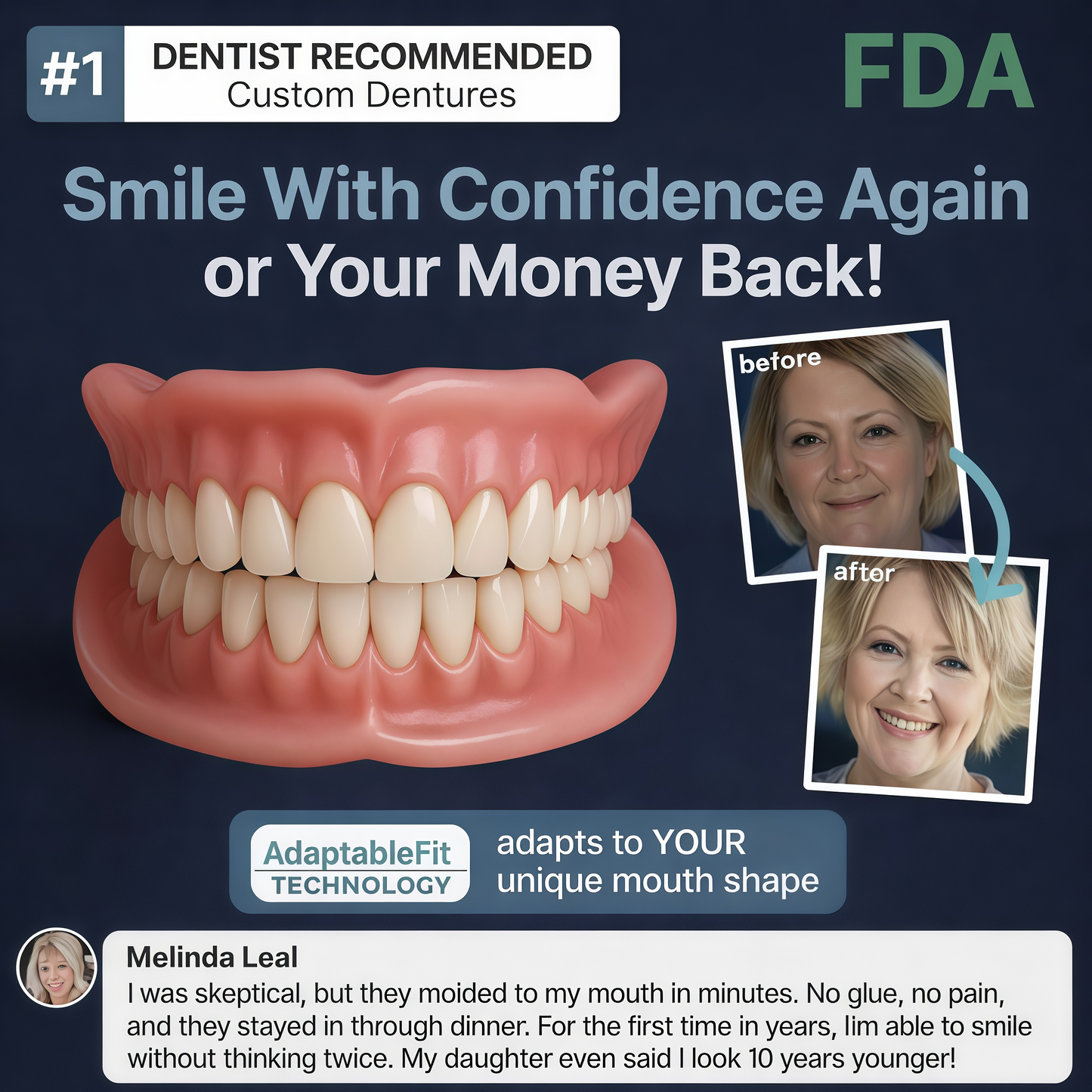 2026🏆✨LAST DAY SALE 70% OFF🔥 Newly upgraded second-generation DarkFairy™  complete dentures