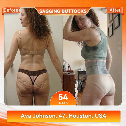 👙Official Brand Store | 2026 Moringa & Berberine 4-In-1 Micro-Particle Sculpting & Fat-Burn Shorts
